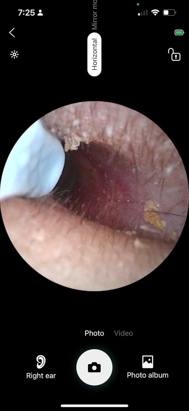 Review image