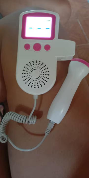 נועם פרץ