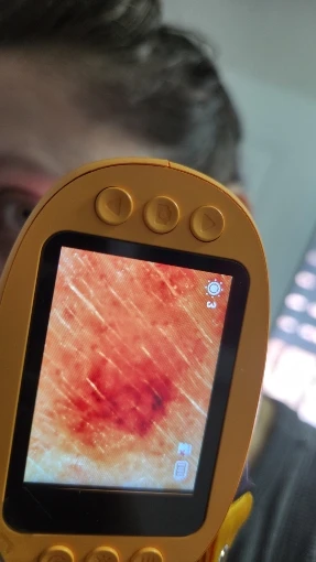 Review image